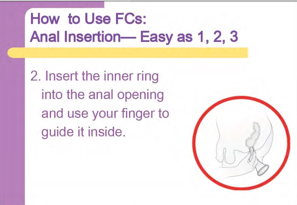 Female Condom For Anal 30